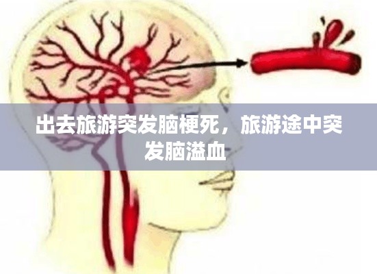 出去旅游突发脑梗死,旅游途中突发脑溢血