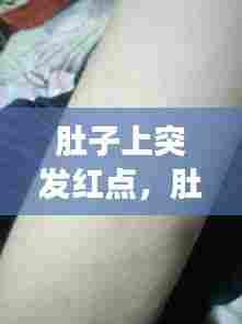 肚子上突发红点,肚子上突然长红点不痒不痛