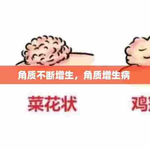 角质不断增生，角质增生病 