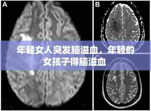 年轻女人突发脑溢血,年轻的女孩子得脑溢血
