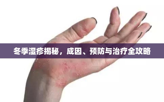 冬季湿疹揭秘，成因、预防与治疗全攻略