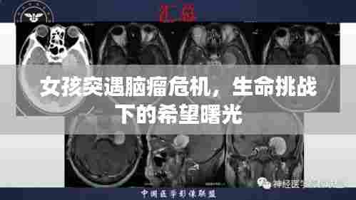 女孩突遇脑瘤危机,生命挑战下的希望曙光